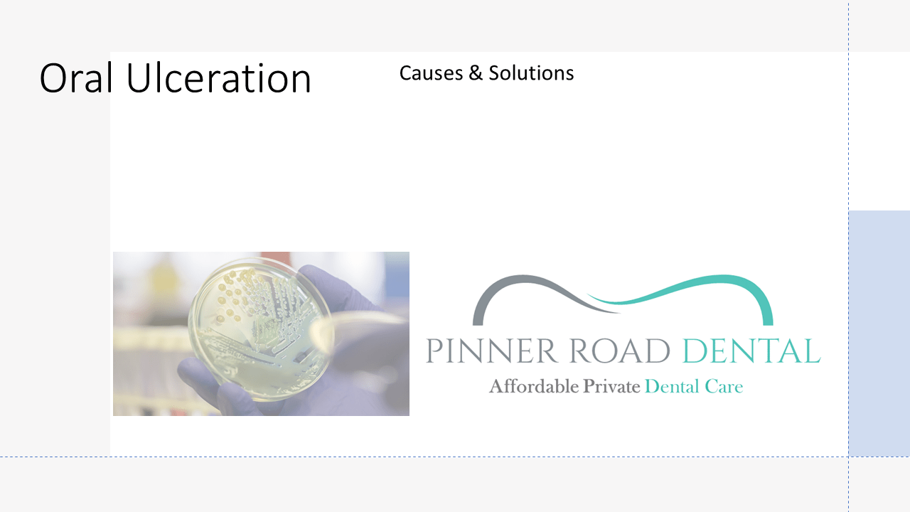 Home Learning Oral Ulceration Pinner Road Dental