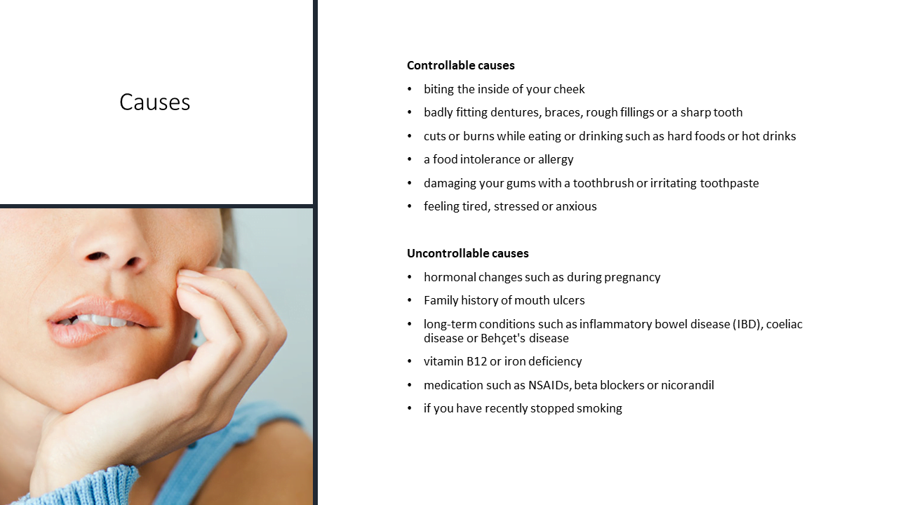Home Learning Oral Ulceration Pinner Road Dental